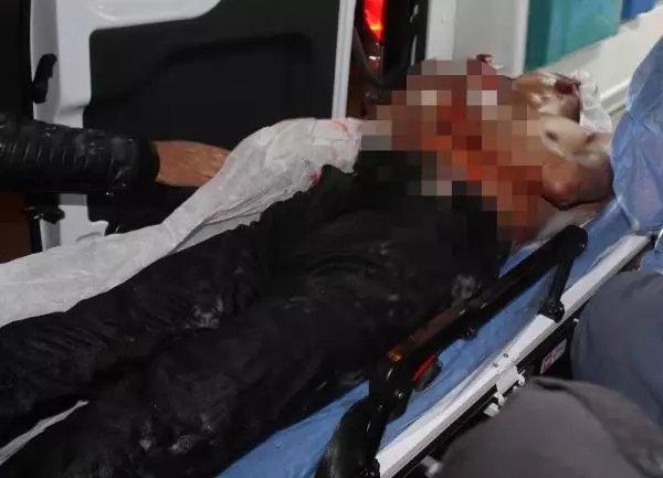 Evini ateşe veren şahıs, kendini cam parçalarıyla yaraladı Evini ateşe veren şahıs, kendini cam parçalarıyla yaraladı