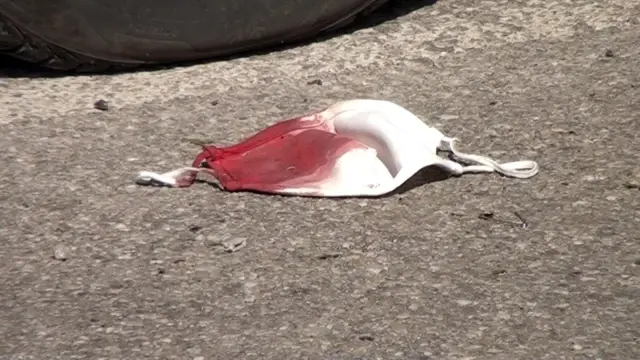 Son dakika haber: Ani karar kazaya davetiye çıkarttı: 1 kişi yaralandı Son dakika haber: Ani karar kazaya davetiye çıkarttı: 1 kişi yaralandı