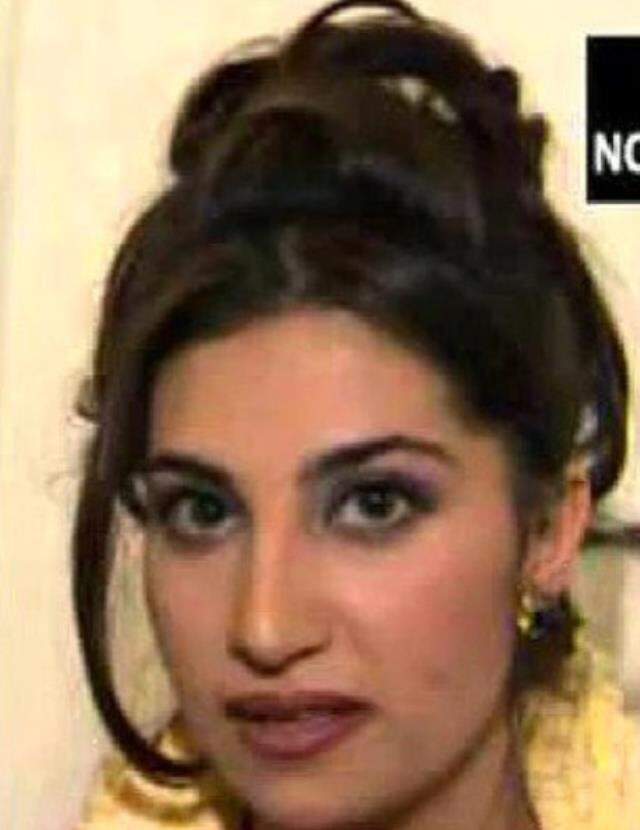 Ebru Yaşar estetikli mi? Ebru Yaşar'ın estetiği var mı?