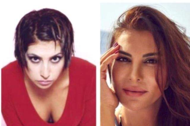 Ebru Yaşar estetikli mi? Ebru Yaşar'ın estetiği var mı?