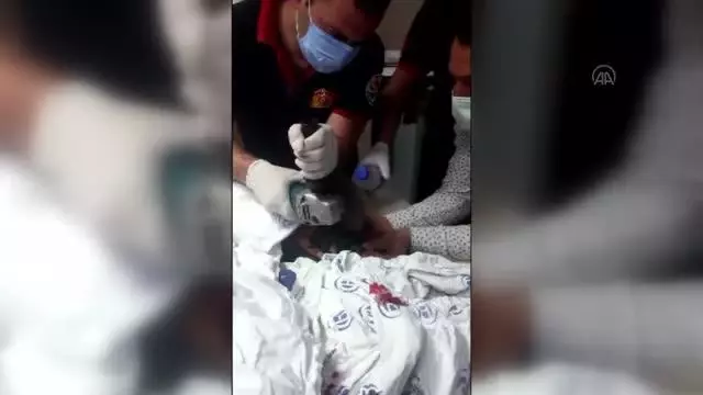 Eli demire sıkışan inşaat işçisini Can-Kur ekipleri kurtardı Eli demire sıkışan inşaat işçisini Can-Kur ekipleri kurtardı