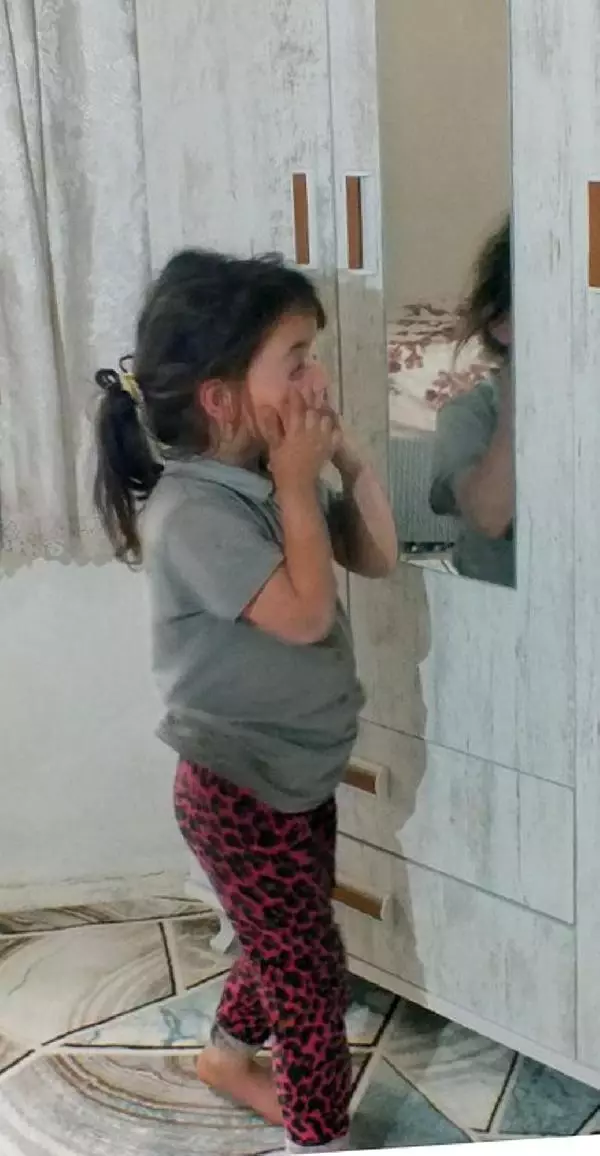 SİBEL ÖĞRETMEN SAYESİNDE İHTİYAÇLARI KARŞILANAN AİLENİN TEK SIKINTISI RABİA'NIN DUDAĞINDAKİ KİTLE SİBEL ÖĞRETMEN SAYESİNDE İHTİYAÇLARI KARŞILANAN AİLENİN TEK SIKINTISI RABİA'NIN DUDAĞINDAKİ KİTLE