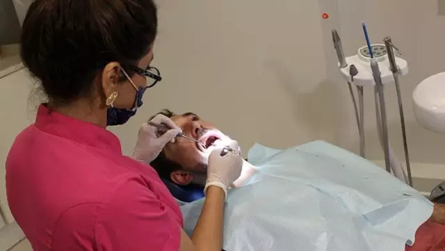 Koronanın bir etkisi daha ortaya çıktı: Ağız yapısını değiştiriyor Koronanın bir etkisi daha ortaya çıktı: Ağız yapısını değiştiriyor