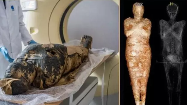 Polonyalı arkeologlar bandajları çıkarınca fark etti: İlk kez hamile kadın mumyası bulundu Polonyalı arkeologlar bandajları çıkarınca fark etti: İlk kez hamile kadın mumyası bulundu