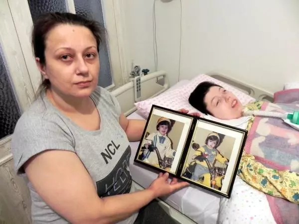 HASTA KIZININ BAŞINDAN 21 YILDIR AYRILMIYOR HASTA KIZININ BAŞINDAN 21 YILDIR AYRILMIYOR