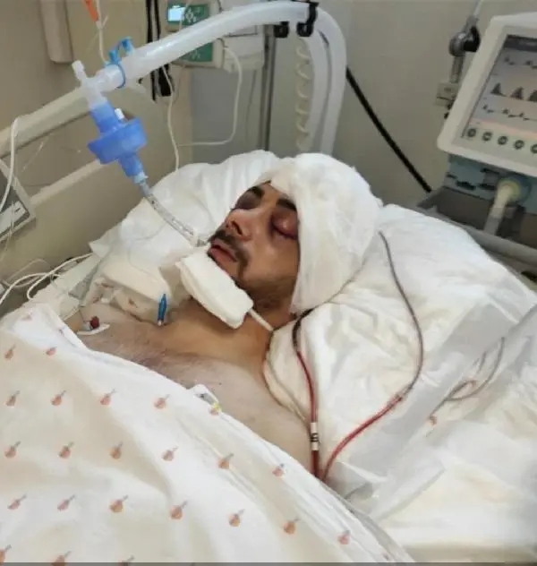 Attan düşen jokeyin yaşam mücadelesi 21 gündür sürüyor Attan düşen jokeyin yaşam mücadelesi 21 gündür sürüyor
