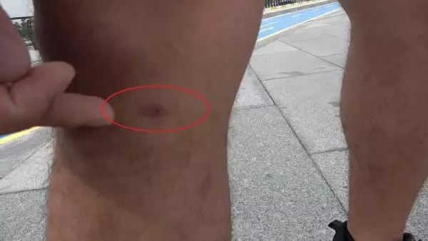 Bisiklet kullanırken yılan saldırısına uğradı Bisiklet kullanırken yılan saldırısına uğradı