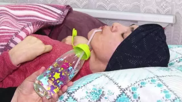 Fedakar anne Kanadı Kırık Meleği ne 41 yıldır bebek gibi bakıyor