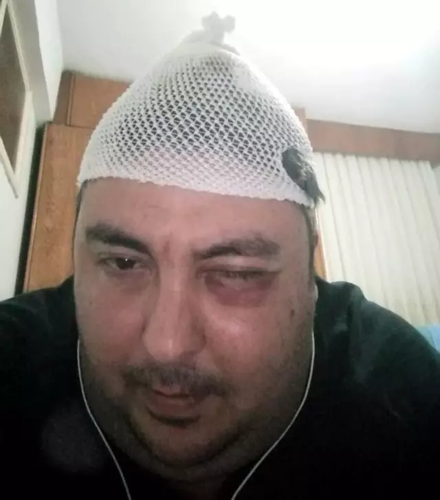 Uyuşturucu tacirlerinin üzerine giden avukat, sokak ortasında saldırıya uğradı Uyuşturucu tacirlerinin üzerine giden avukat, sokak ortasında saldırıya uğradı
