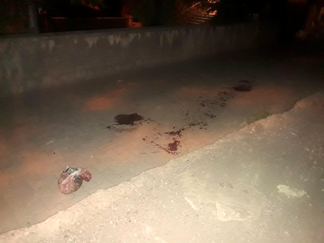 Son dakika haberi! Çorum'da silahlı saldırı: 1 ölü