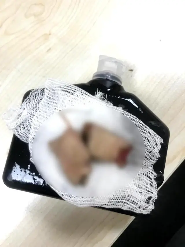 Elinde havai fişek patlayan adamın parmaklarını bulup dondurucuda sakladı Elinde havai fişek patlayan adamın parmaklarını bulup dondurucuda sakladı