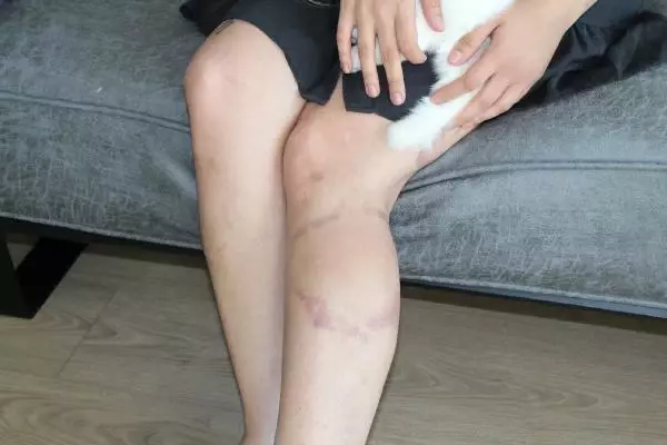 Eski eşini, 'borç para' vermediği gerekçesiyle beyzbol sopasıyla darbetti Eski eşini, 'borç para' vermediği gerekçesiyle beyzbol sopasıyla darbetti