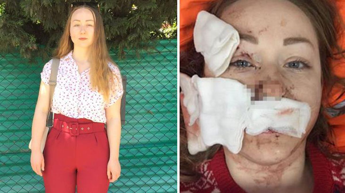 Alışveriş merkezinde eşinin falçatalı saldırısına uğrayan Hanna: O gün öleceğim sandım, ama artık korkmuyorum