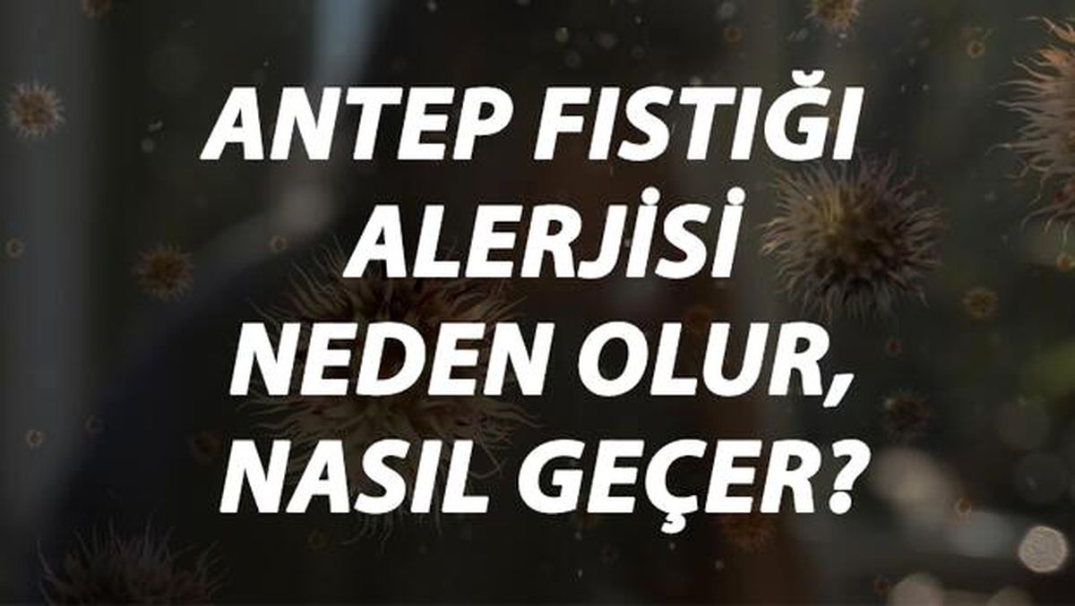 Antep Fıstığı Alerjisi Nedir, Neden Olur ve Nasıl Geçer? Antep Fıstığı Alerjisi Belirtileri ve Tedavisi Hakkında Bilgi