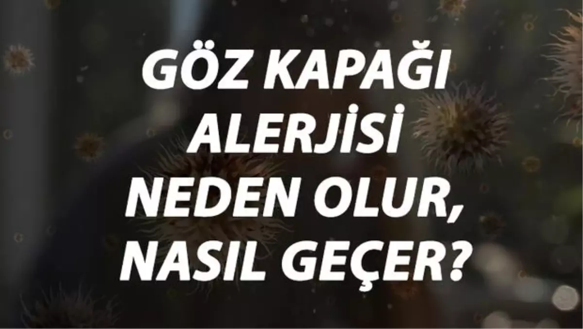 Göz Kapağı Alerjisi Nedir, Neden Olur ve Nasıl Geçer? Göz Kapağı Alerjisi Belirtileri ve Tedavisi Hakkında Bilgi