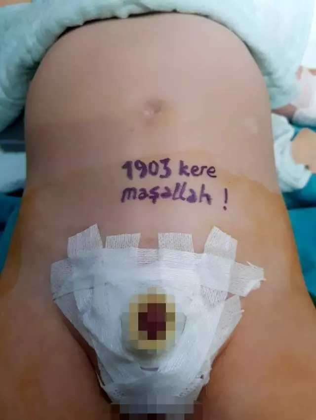 Son dakika haberi! Sünnet ettiği çocukların göbeğine '1903 kere maşallah' yazarak sakinleştiriyor Son dakika haberi! Sünnet ettiği çocukların göbeğine '1903 kere maşallah' yazarak sakinleştiriyor