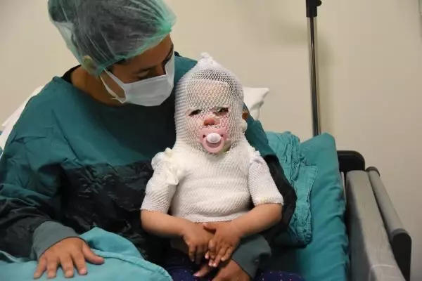 Beril bebekten iyi haber; hayati tehlikesi yok Beril bebekten iyi haber; hayati tehlikesi yok