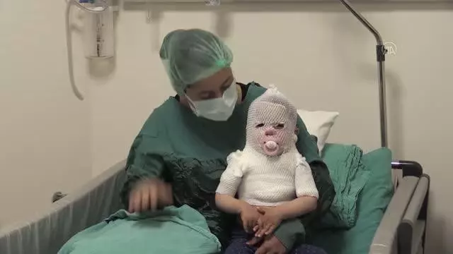 ESKİŞEHİR - Afyonkarahisar'da üzerine sıcak su dökülen bebeğin Eskişehir'de tedavisi sürüyor ESKİŞEHİR - Afyonkarahisar'da üzerine sıcak su dökülen bebeğin Eskişehir'de tedavisi sürüyor