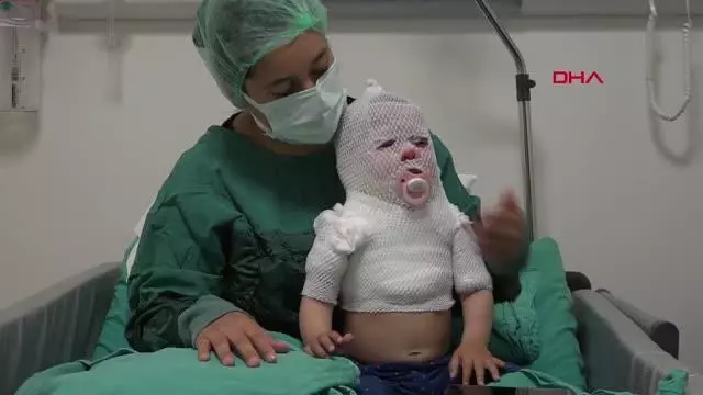 ESKİŞEHİR Kaynar suyla haşlanan Beril bebek Yanık Merkezi'nde tedavi altında ESKİŞEHİR Kaynar suyla haşlanan Beril bebek Yanık Merkezi'nde tedavi altında