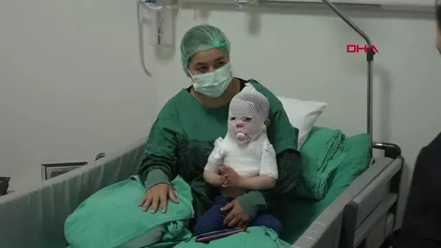 ESKİŞEHİR Kaynar suyla haşlanan Beril bebek Yanık Merkezi'nde tedavi altında ESKİŞEHİR Kaynar suyla haşlanan Beril bebek Yanık Merkezi'nde tedavi altında