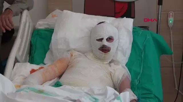 ÜZERİNE YILDIRIM DÜŞEN ÇOBAN AĞIR YARALANDI ÜZERİNE YILDIRIM DÜŞEN ÇOBAN AĞIR YARALANDI