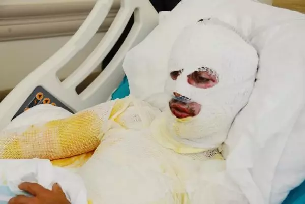 Talihsizliğin böylesi! Hayvanlarını otlatırken üzerine yıldırım düşen çoban, ağır yaralandı Talihsizliğin böylesi! Hayvanlarını otlatırken üzerine yıldırım düşen çoban, ağır yaralandı
