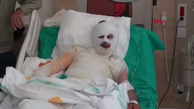ÜZERİNE YILDIRIM DÜŞEN ÇOBAN AĞIR YARALANDI ÜZERİNE YILDIRIM DÜŞEN ÇOBAN AĞIR YARALANDI
