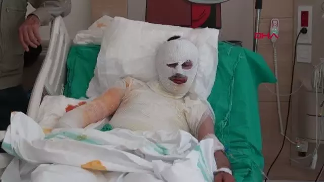 ÜZERİNE YILDIRIM DÜŞEN ÇOBAN AĞIR YARALANDI ÜZERİNE YILDIRIM DÜŞEN ÇOBAN AĞIR YARALANDI