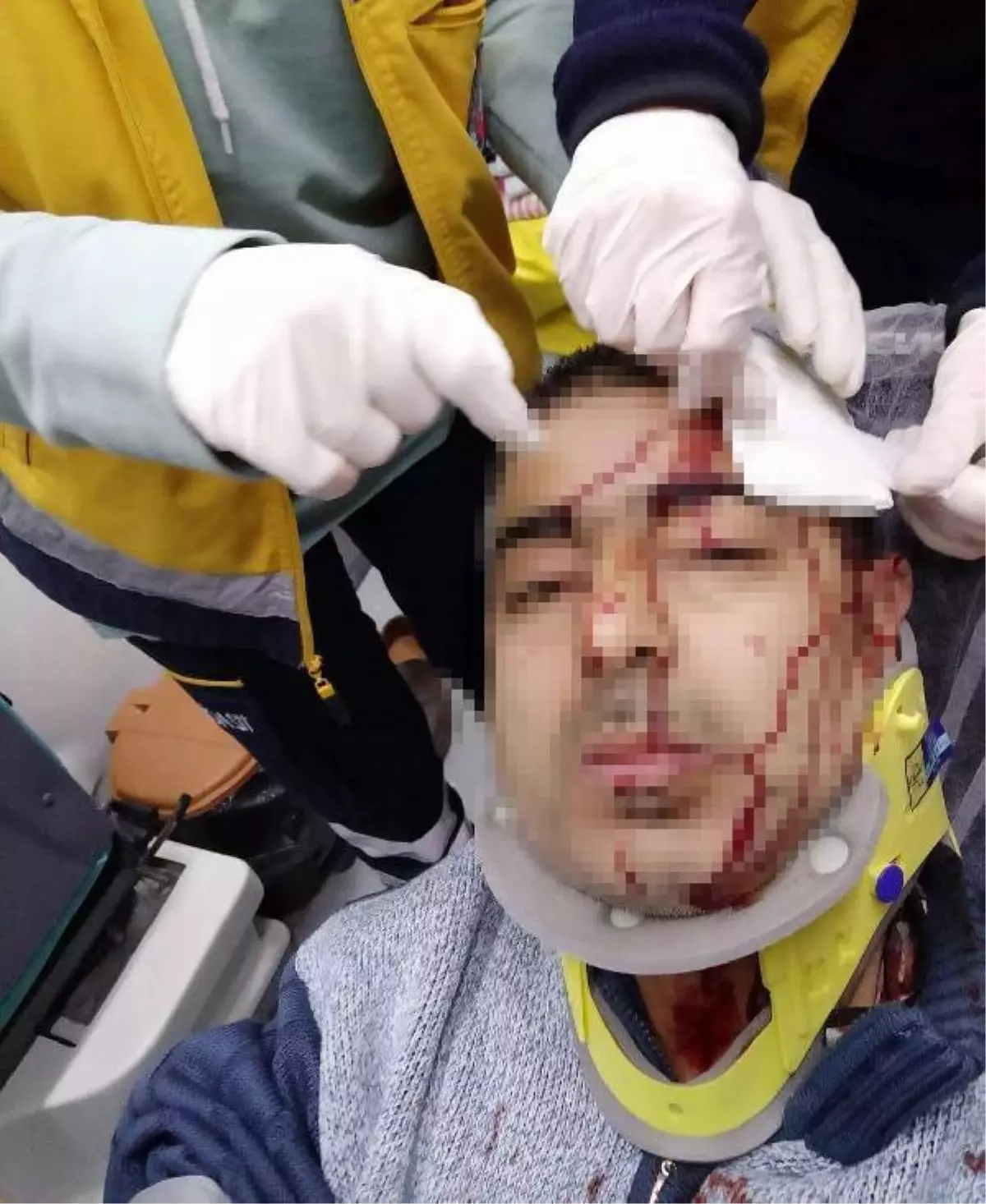 İmamın tabureyle saldırdığı müezzinin kafasına 10 dikiş atıldı