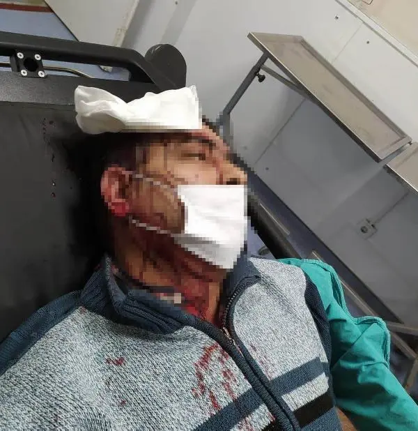 İmamın tabureyle saldırdığı müezzinin kafasına 10 dikiş atıldı İmamın tabureyle saldırdığı müezzinin kafasına 10 dikiş atıldı