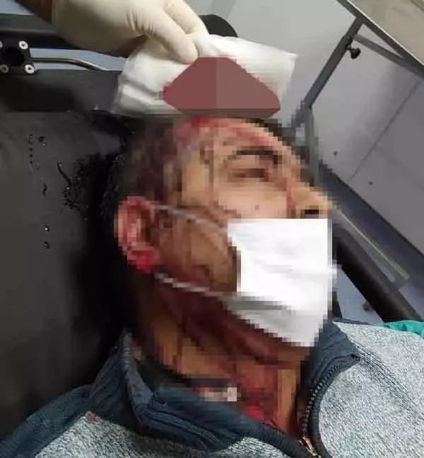 İmamın tabureyle saldırdığı müezzinin kafasına 10 dikiş atıldı İmamın tabureyle saldırdığı müezzinin kafasına 10 dikiş atıldı