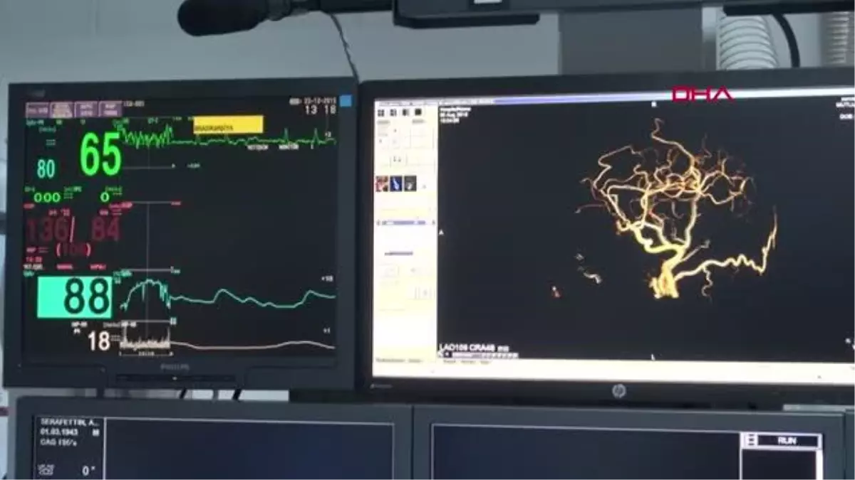 İSTANBUL-RİTİM BOZUKLUĞU ÖNEMSENMEYEN BELİRTİYLE KENDİNİ GÖSTEREBİLİR