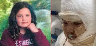 Korkunç olay! Tiktok'taki alkolle yazı yazma akımına katılan 13 yaşındaki kız çocuğu, alevler içerisinde kaldı