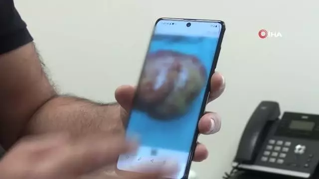 Karnından 6 kiloluk tümör çıkarıldı Karnından 6 kiloluk tümör çıkarıldı