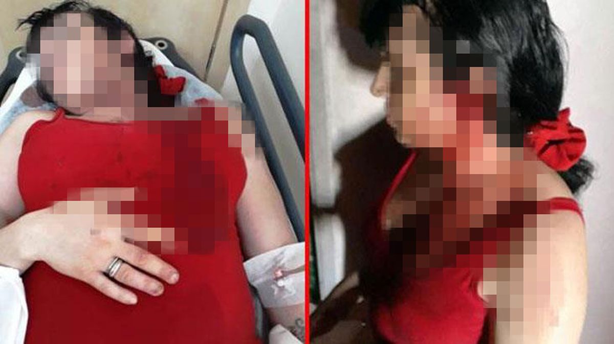 Trans birey, komşuları tarafından beyzbol sopasıyla dövüldü