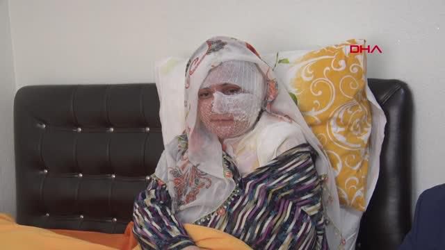 esinin kizgin yag ile yaktigi kadin olmek 14175352 o
