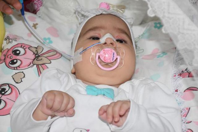 SMA'lı Elif bebek hayatını kaybetti, toplanan 2,4 milyon lira diğer hastalara dağıtılacak SMA'lı Elif bebek hayatını kaybetti, toplanan 2,4 milyon lira diğer hastalara dağıtılacak