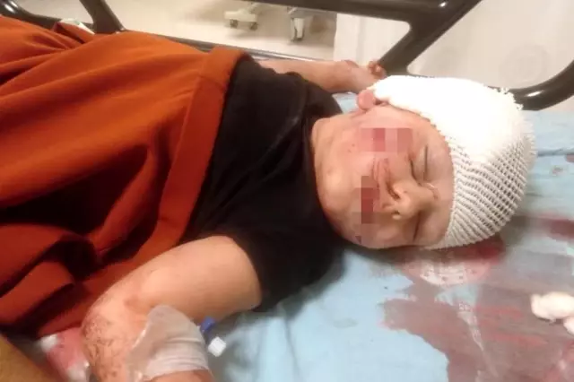 Köpek saldırısına uğrayan 3,5 yaşındaki çocuktan yürek burkan sözler: Sevmek istedim ama sevemedim...