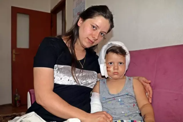 Sevmek istediği köpeğin saldırısına uğrayan minik Yağız�ın kafasına 50