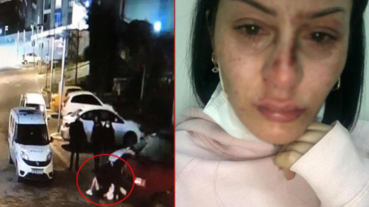 Polis tarafından dövüldüğü gerekçesiyle şikayette bulunan kadından bomba iddia: Doktor 'Az bile benzetmişsiniz' dedi