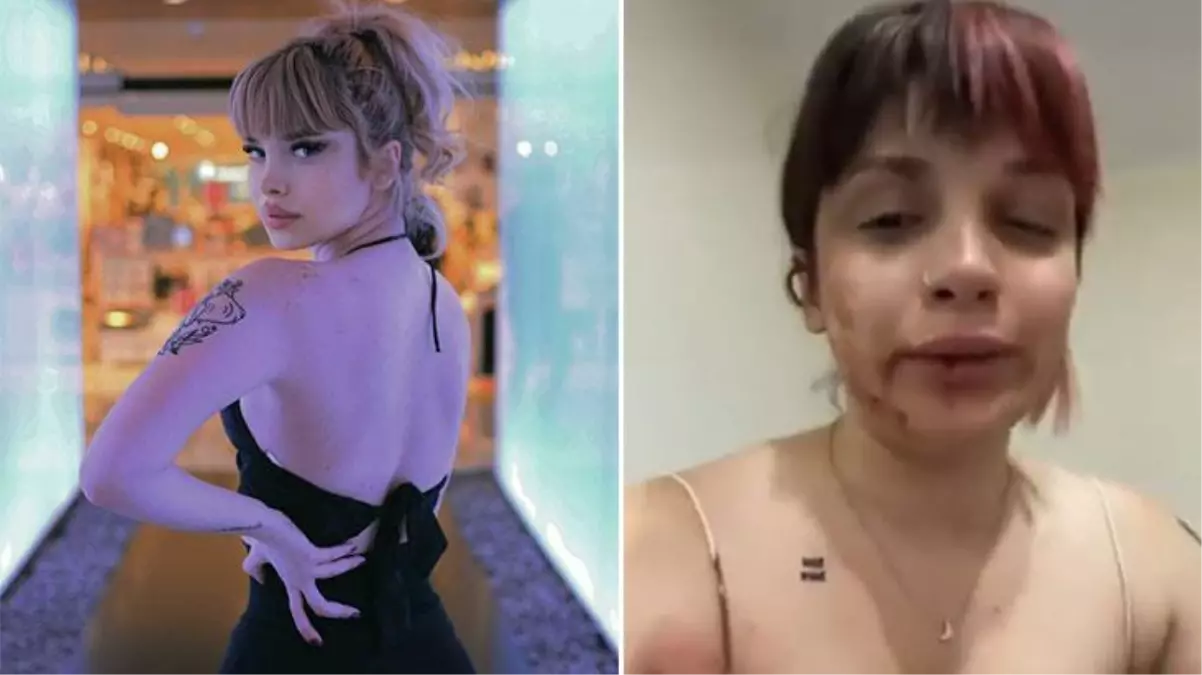 Tayt giydiği için erkek arkadaşından dayak yiyen genç kız Tayt giydiği için erkek arkadaşından dayak yiyen genç kız