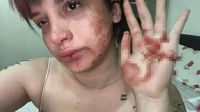 Sosyal medya fenomeni kız arkadaşını tayt giydiği için darbeden oyuncu, serbest bırakıldı