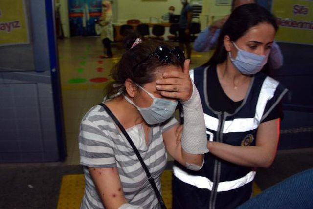 Erkek arkadaşını yüzüne kezzap attı, tahliye edildi