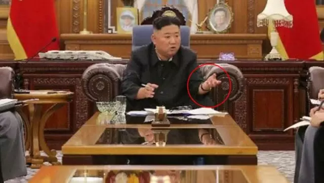 Kilo kaybı yaşayan Kim Jong-un'un sağlık durumu endişelendirdi Kilo kaybı yaşayan Kim Jong-un'un sağlık durumu endişelendirdi