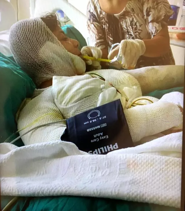 Kızı yanarak, oğlu boğularak ölen annenin feryadı Kızı yanarak, oğlu boğularak ölen annenin feryadı