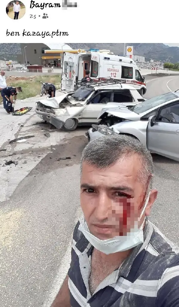 KAZADA BAŞINDAN YARALANDI, İLK İŞİ SELFİE YAPIP PAYLAŞMAK OLDU KAZADA BAŞINDAN YARALANDI, İLK İŞİ SELFİE YAPIP PAYLAŞMAK OLDU