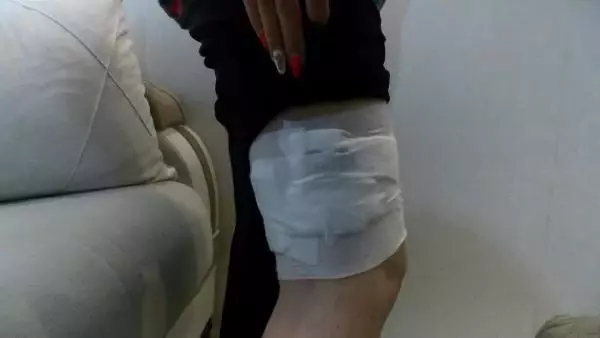 ESENYURT'TA EKMEK ALMAYA GİDEN KADIN, SOKAK KÖPEKLERİNİN SALDIRISINA UĞRADI ESENYURT'TA EKMEK ALMAYA GİDEN KADIN, SOKAK KÖPEKLERİNİN SALDIRISINA UĞRADI