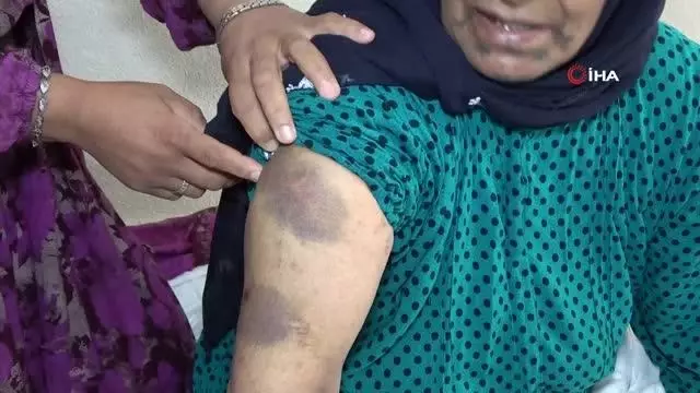 Yaşlı kadına yoğun bakımda darp iddiası Yaşlı kadına yoğun bakımda darp iddiası