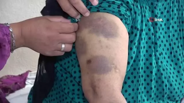 Yaşlı kadına yoğun bakımda darp iddiası Yaşlı kadına yoğun bakımda darp iddiası