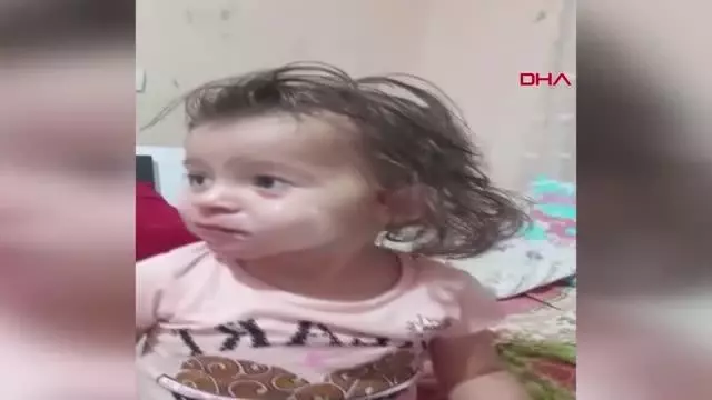 BURDUR DOKTORLARIN 3 AY ÖMÜR BİÇTİĞİ MİNİK HİRA'NIN BEYİN ÖLÜMÜ GERÇEKLEŞTİ BURDUR DOKTORLARIN 3 AY ÖMÜR BİÇTİĞİ MİNİK HİRA'NIN BEYİN ÖLÜMÜ GERÇEKLEŞTİ